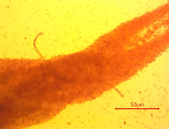 Chlorophyllum molybdites