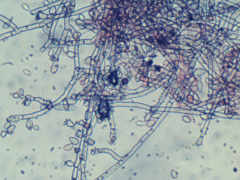 Botryobasidium conspersum