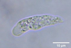 Amoebozoa