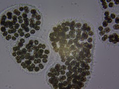 Microcystis wesenbergii