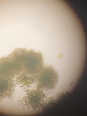 Dolichospermum lemmermannii