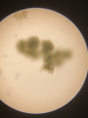 Dolichospermum lemmermannii