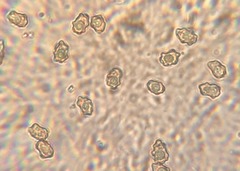 Inocybe nothomixtilis