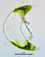 Spinoclosterium cuspidatum