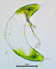 Spinoclosterium cuspidatum