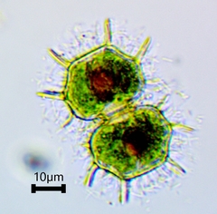 Xanthidium cristatum