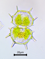 Xanthidium cristatum