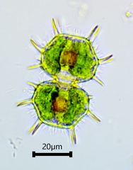 Xanthidium cristatum