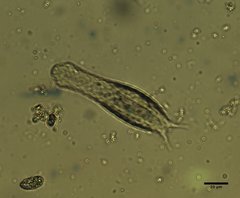 Chaetonotidae