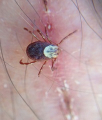 Dermacentor andersoni