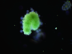 Dolichospermum lemmermannii