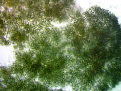 Dolichospermum lemmermannii