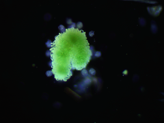 Dolichospermum lemmermannii