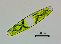 Closterium navicula