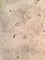 Gastrotricha