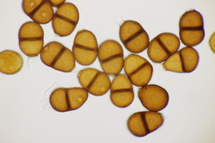 Puccinia calcitrapae