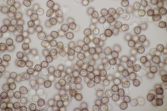 Microbotryum anomalum