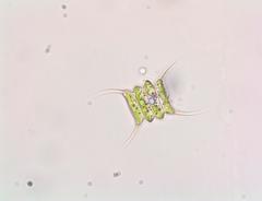 Scenedesmus quadricauda