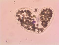 Microcystis wesenbergii