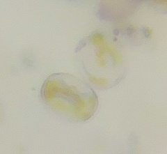 Thalassiosirales