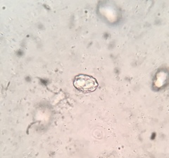 Peziza atrovinosa