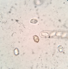 Peziza atrovinosa