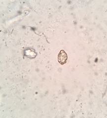 Peziza atrovinosa