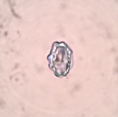 Peziza atrovinosa