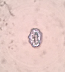 Peziza atrovinosa