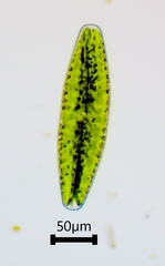 Netrium digitus