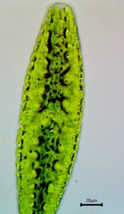 Netrium digitus
