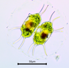 Xanthidium antilopaeum