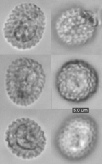 Microbotryum scabiosae