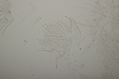 Trichoderma citrinum