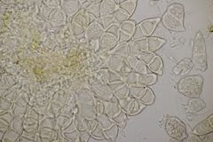 Puccinia glechomatis