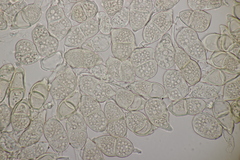 Puccinia glechomatis