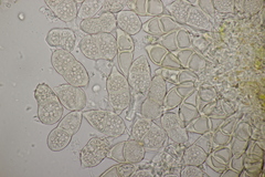 Puccinia glechomatis