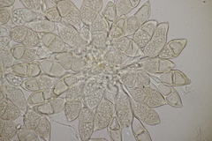 Puccinia glechomatis