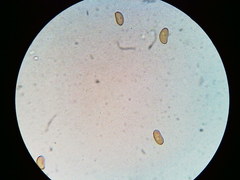 Pseudosperma friabile