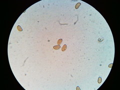 Pseudosperma friabile
