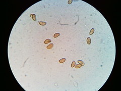 Pseudosperma friabile
