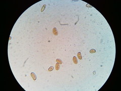 Pseudosperma friabile