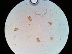 Pseudosperma friabile