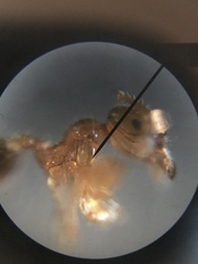 Pheidole tysoni