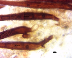 Scutellinia vitreola