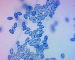 Scutellinia vitreola