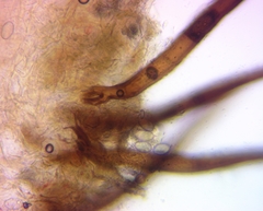 Scutellinia vitreola