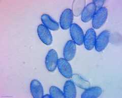 Scutellinia vitreola