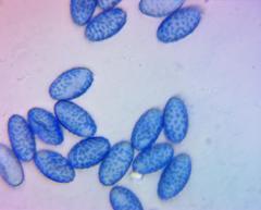 Scutellinia vitreola