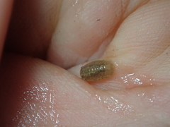 Lekanesphaera rugicauda